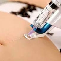 Pistolet injecteur électronique de mésothérapie